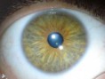 /album/iridologia/dsc00740iris-direita-jpg/